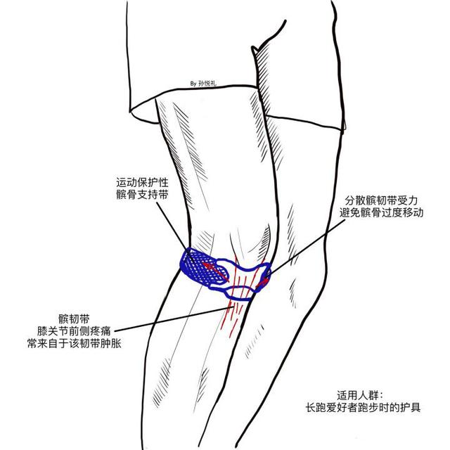 关节套运动护膝怎么用_关节套运动护膝图片_运动护膝关节套